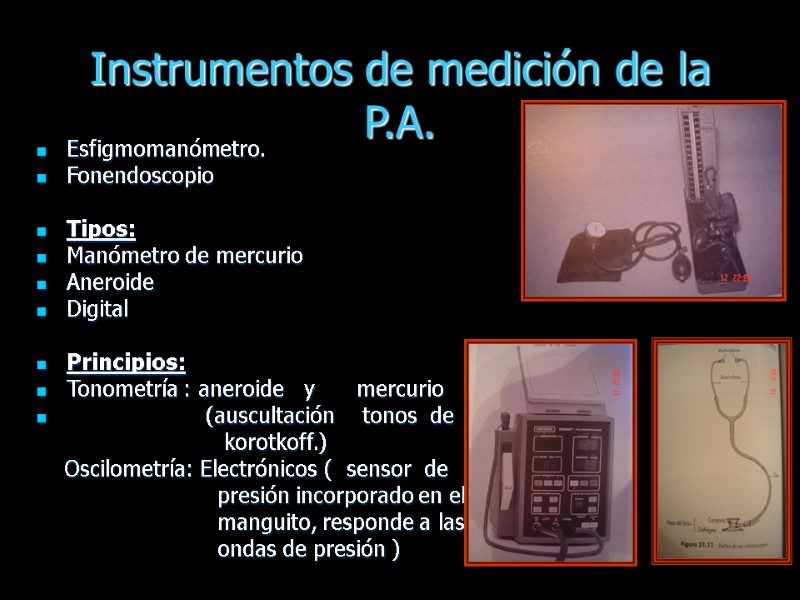 Instrumentos de medición de la P.A. Esfigmomanómetro. Fonendoscopio  Tipos: Manómetro de mercurio Aneroide